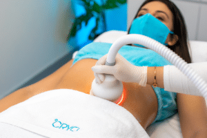 how does cryo help with slimming