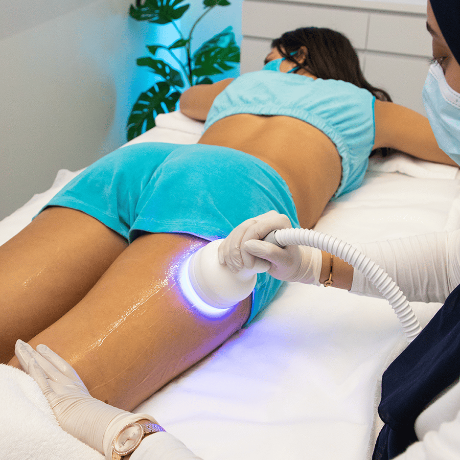cryolipolysis sydney treatment